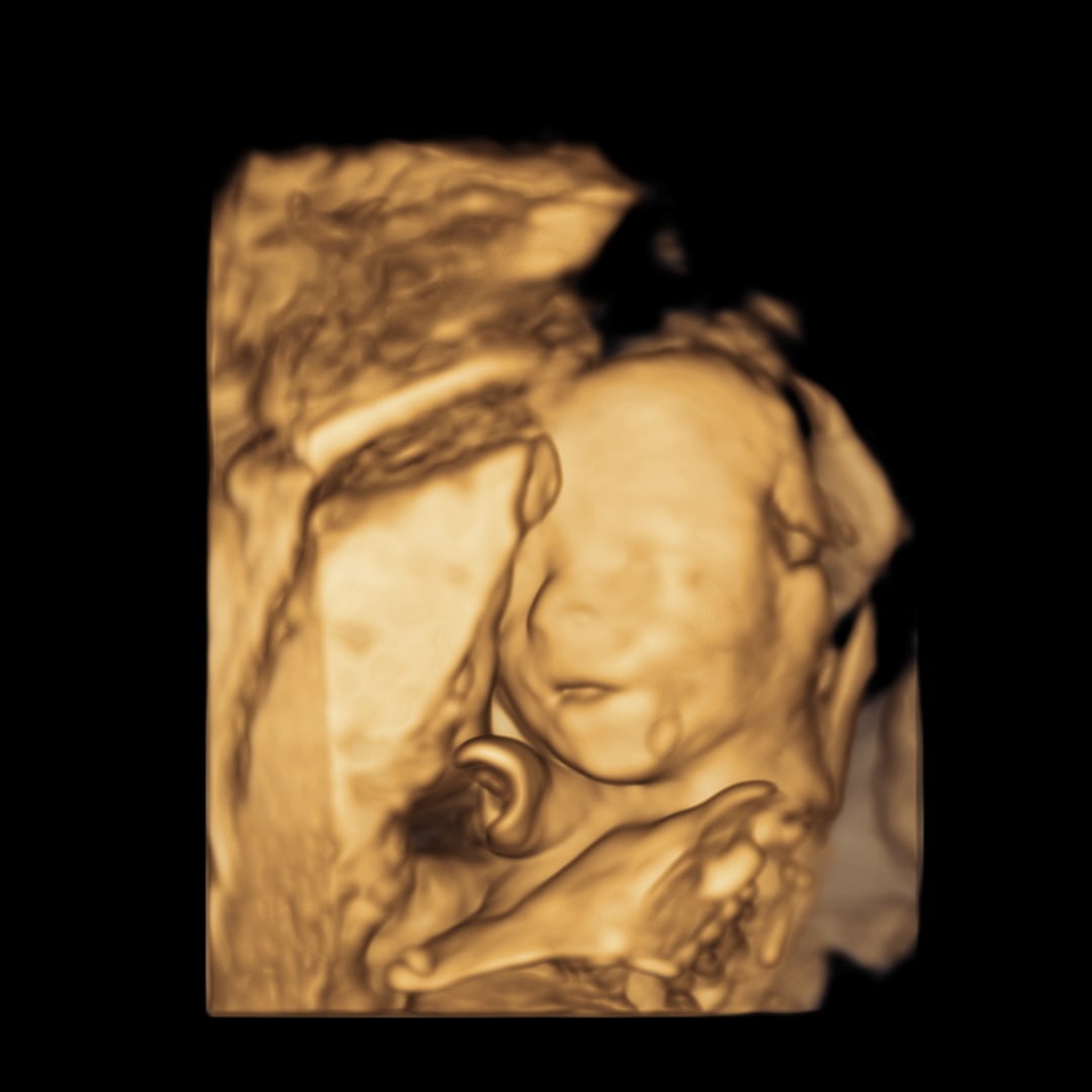 Photo shared by Lilli for their Babylist baby registry.