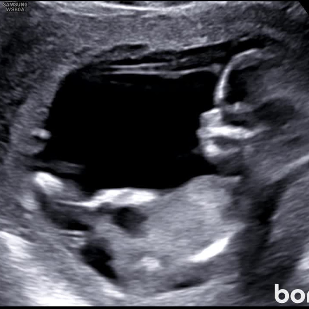 Photo shared by Morgan for their Babylist baby registry.