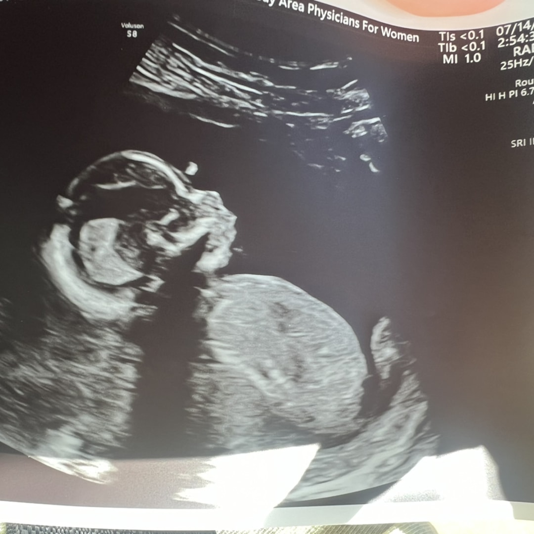 Photo shared by Jamison for their Babylist baby registry.