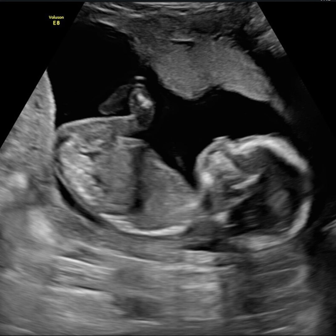Photo shared by Kaylee for their Babylist baby registry.