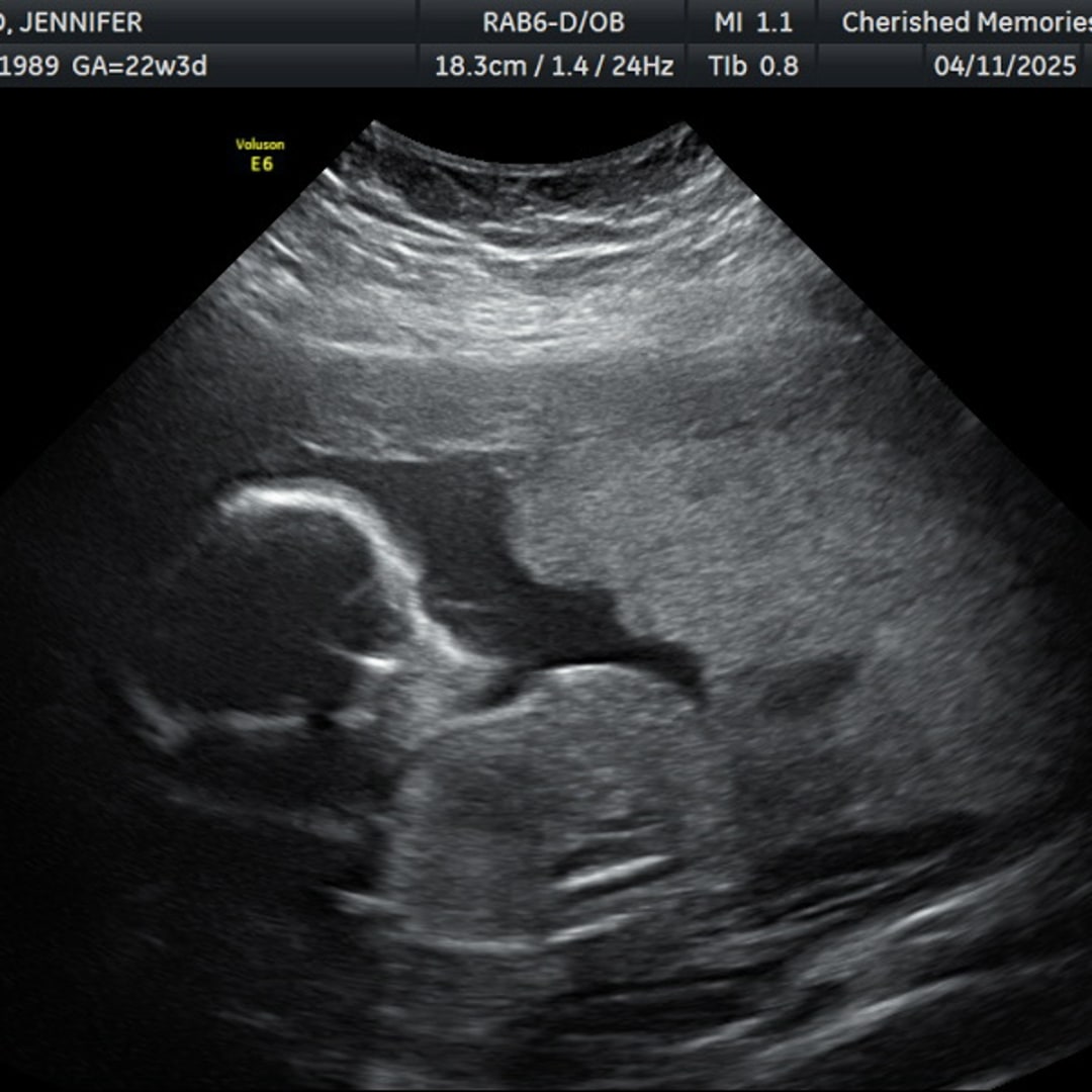 Photo shared by Jennifer for their Babylist baby registry.