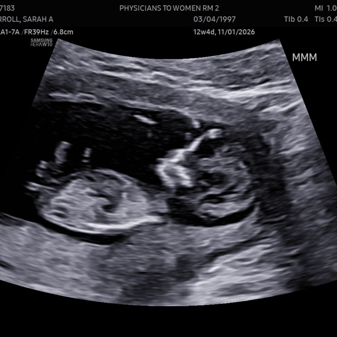 Photo shared by Sarah for their Babylist baby registry.