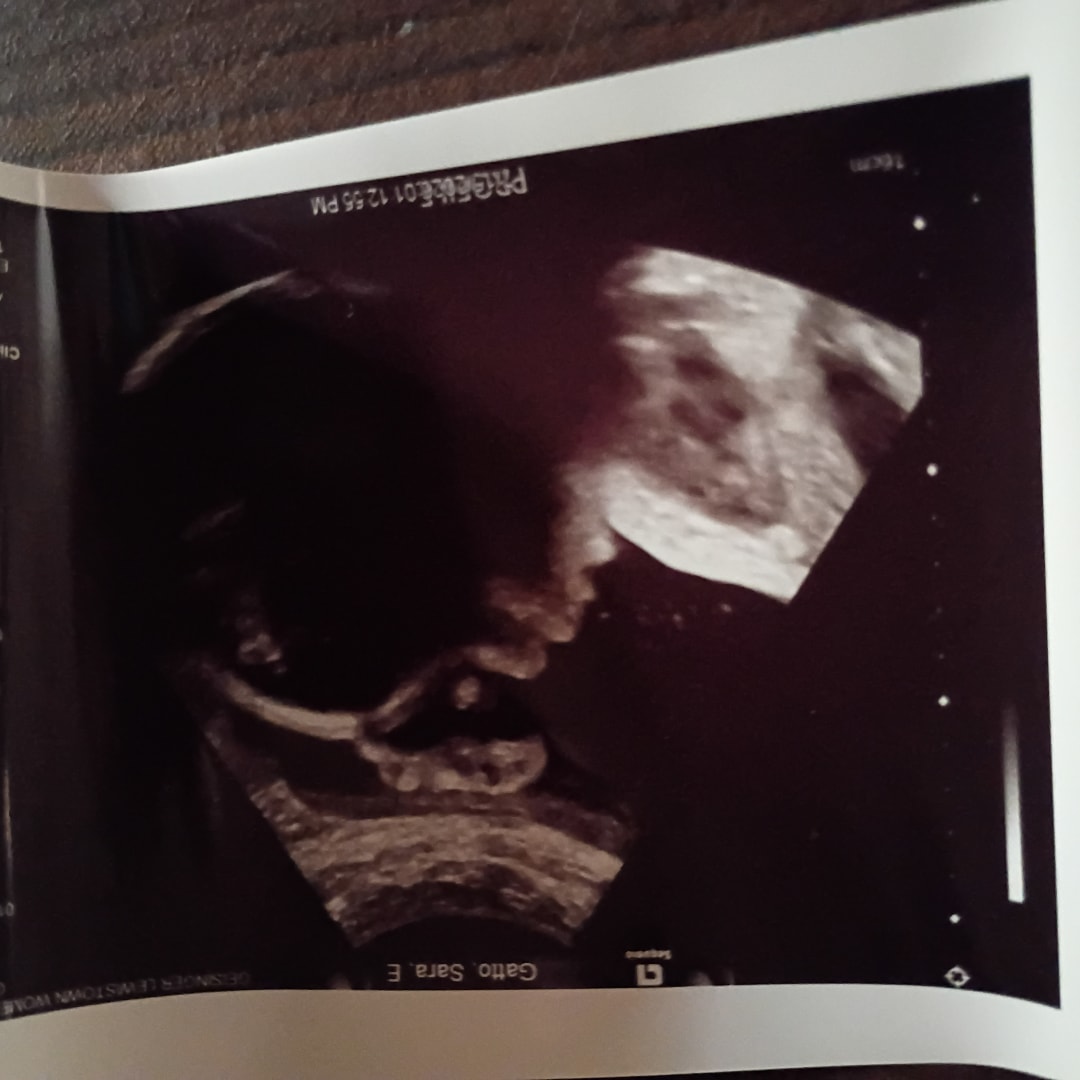 Photo shared by Sara for their Babylist baby registry.