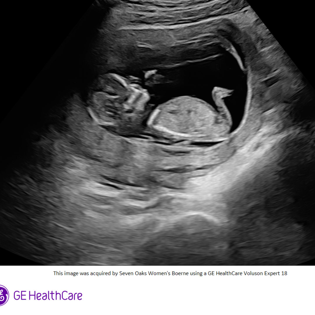 Photo shared by Guerline for their Babylist baby registry.