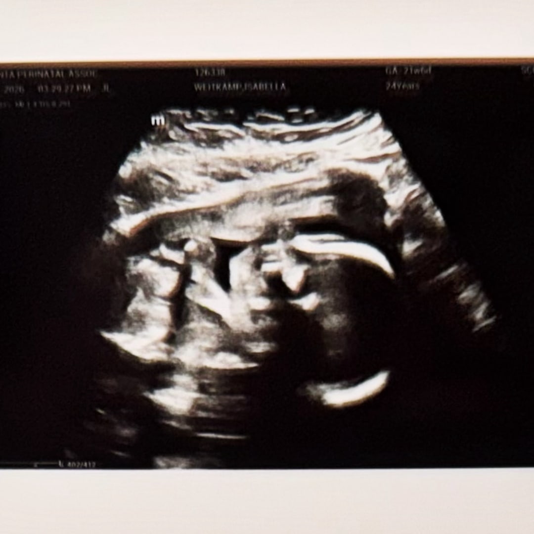 Photo shared by Isabella for their Babylist baby registry.