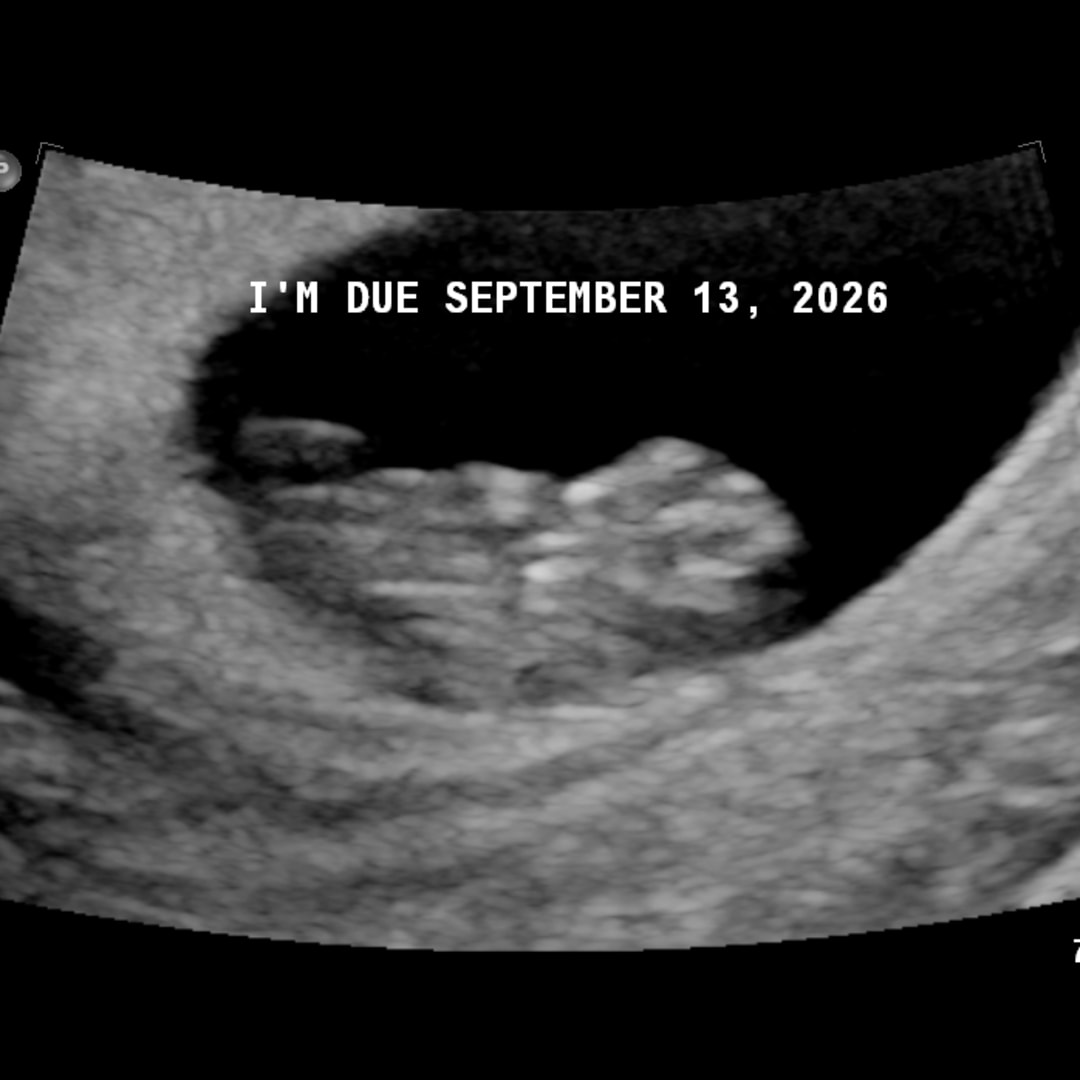 Photo shared by Deiy for their Babylist baby registry.