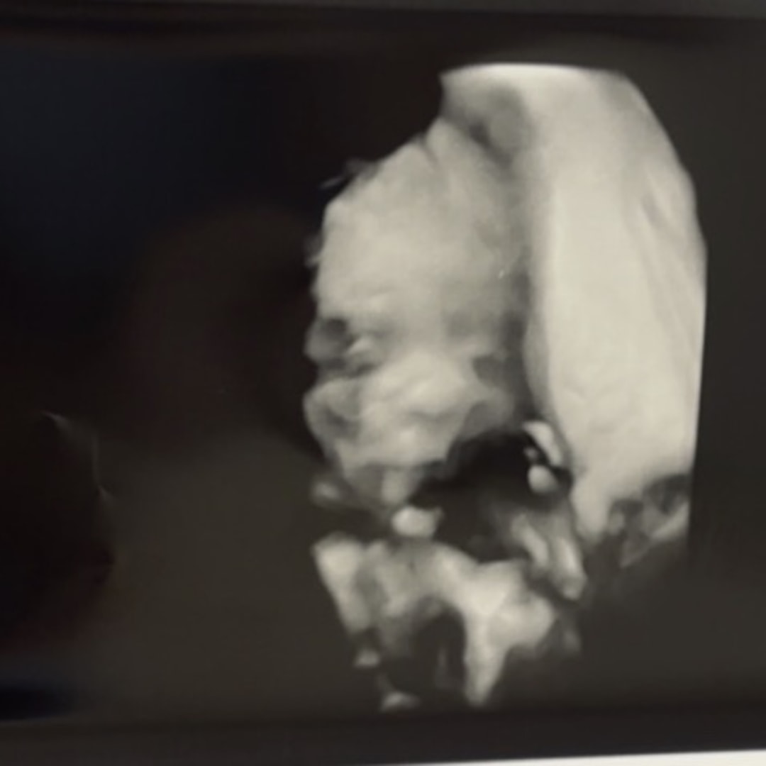 Photo shared by Samantha for their Babylist baby registry.