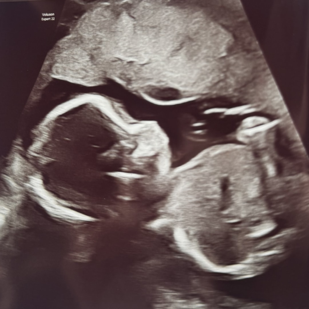 Photo shared by Haylee for their Babylist baby registry.