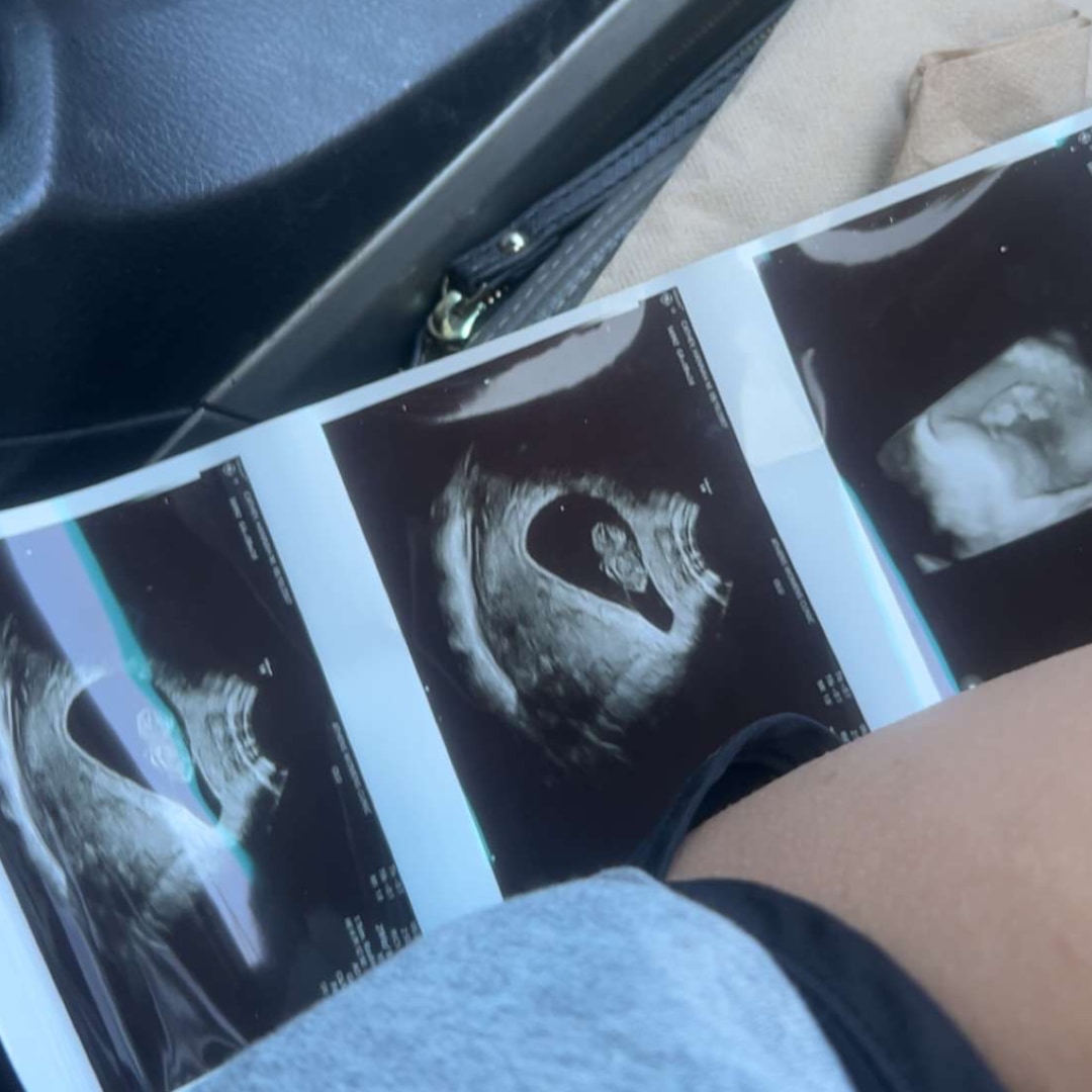 Photo shared by Hannah for their Babylist baby registry.