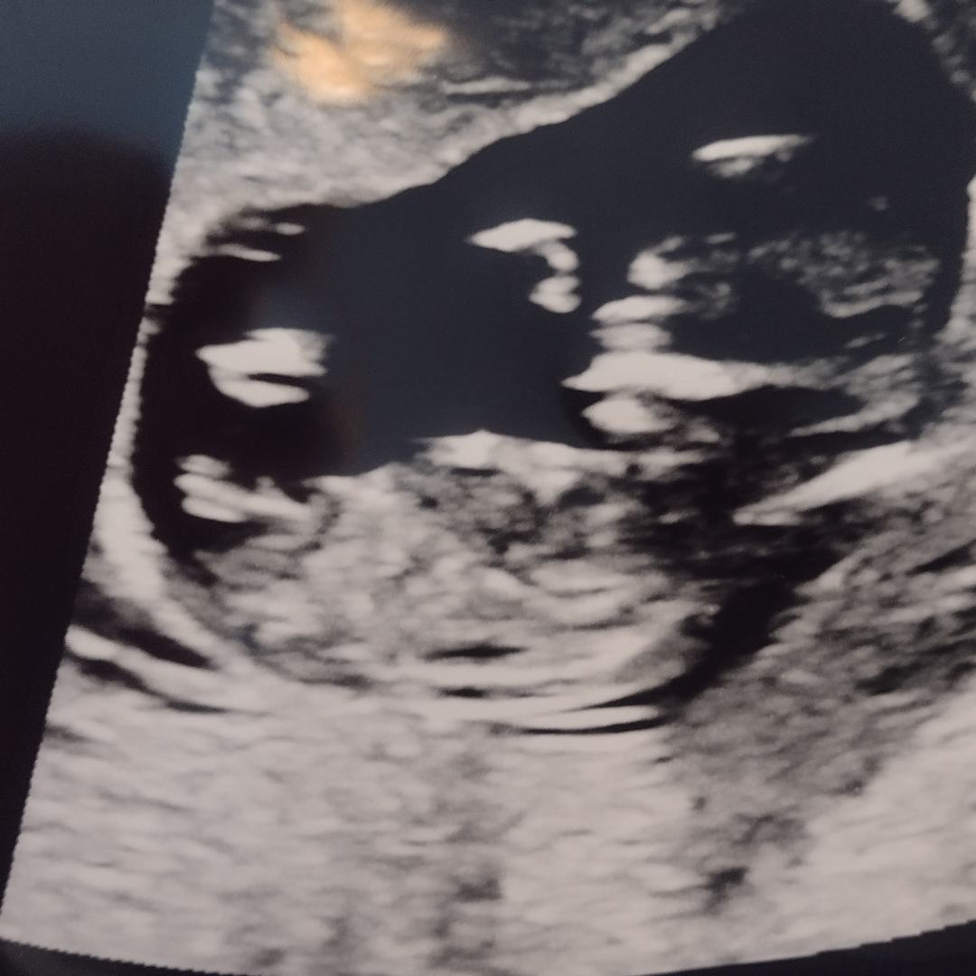 Photo shared by Anna for their Babylist baby registry.