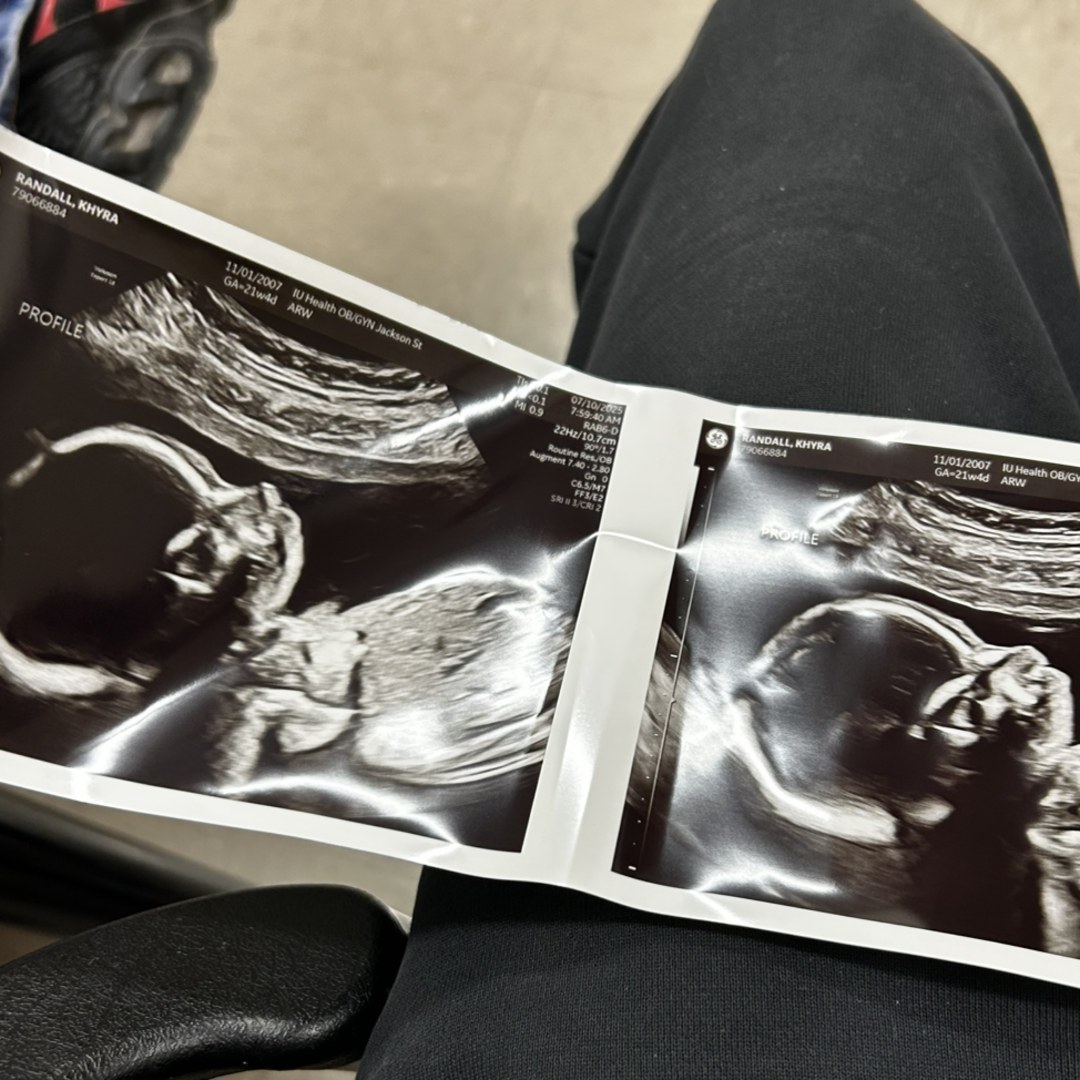 Photo shared by AJ for their Babylist baby registry.