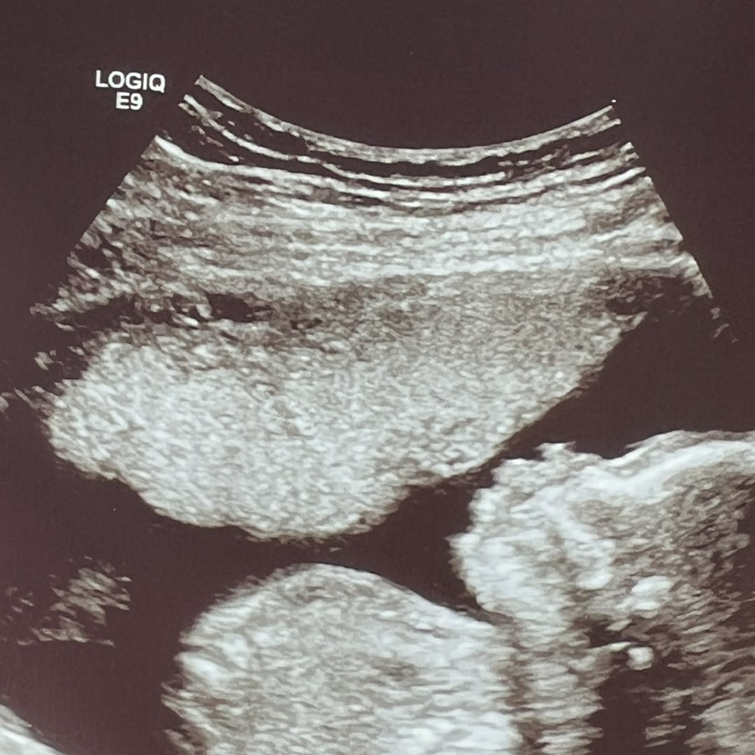 Photo shared by Maria for their Babylist baby registry.