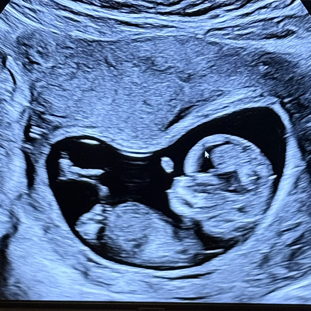 Photo shared by Eden for their Babylist baby registry.