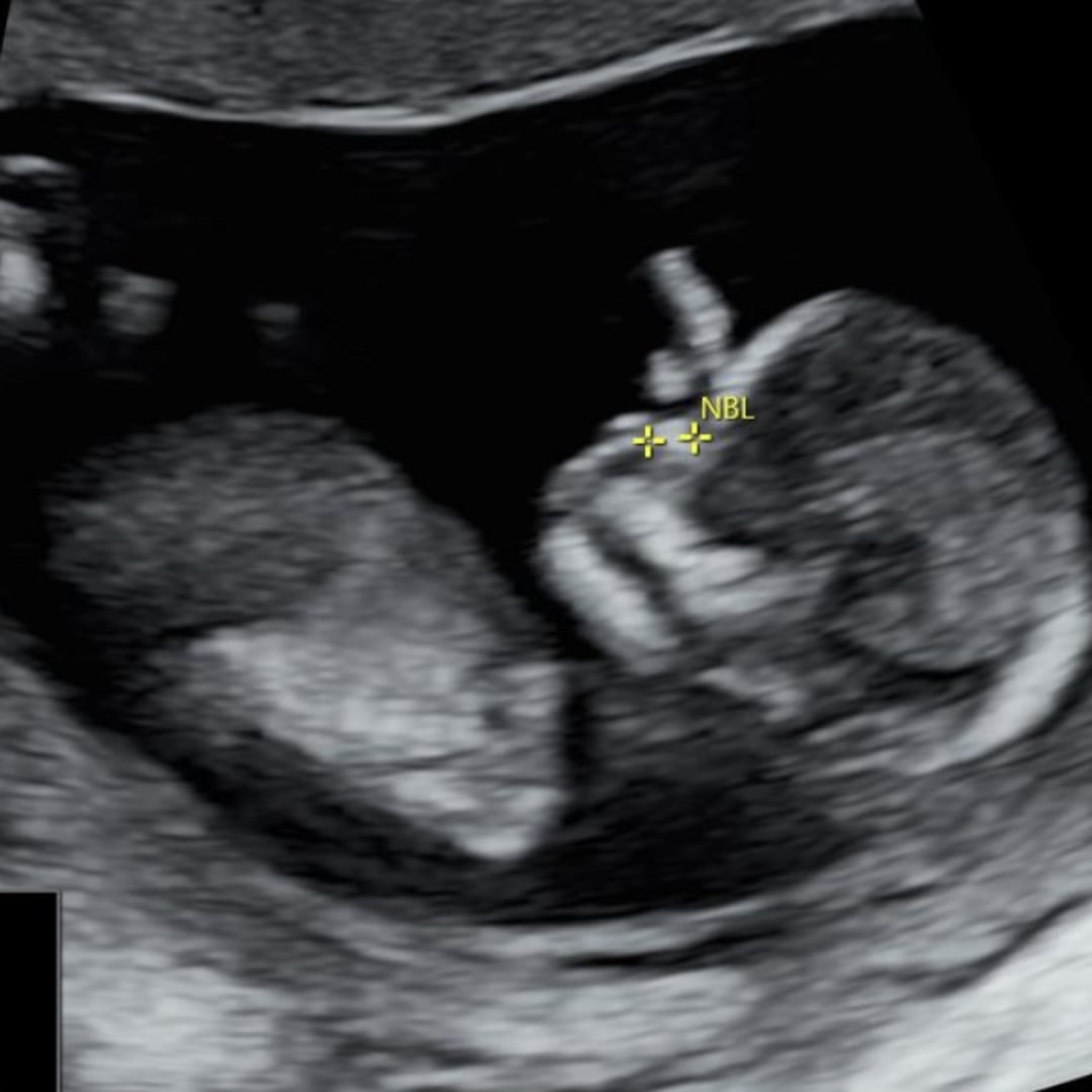 Photo shared by Fatema for their Babylist baby registry.