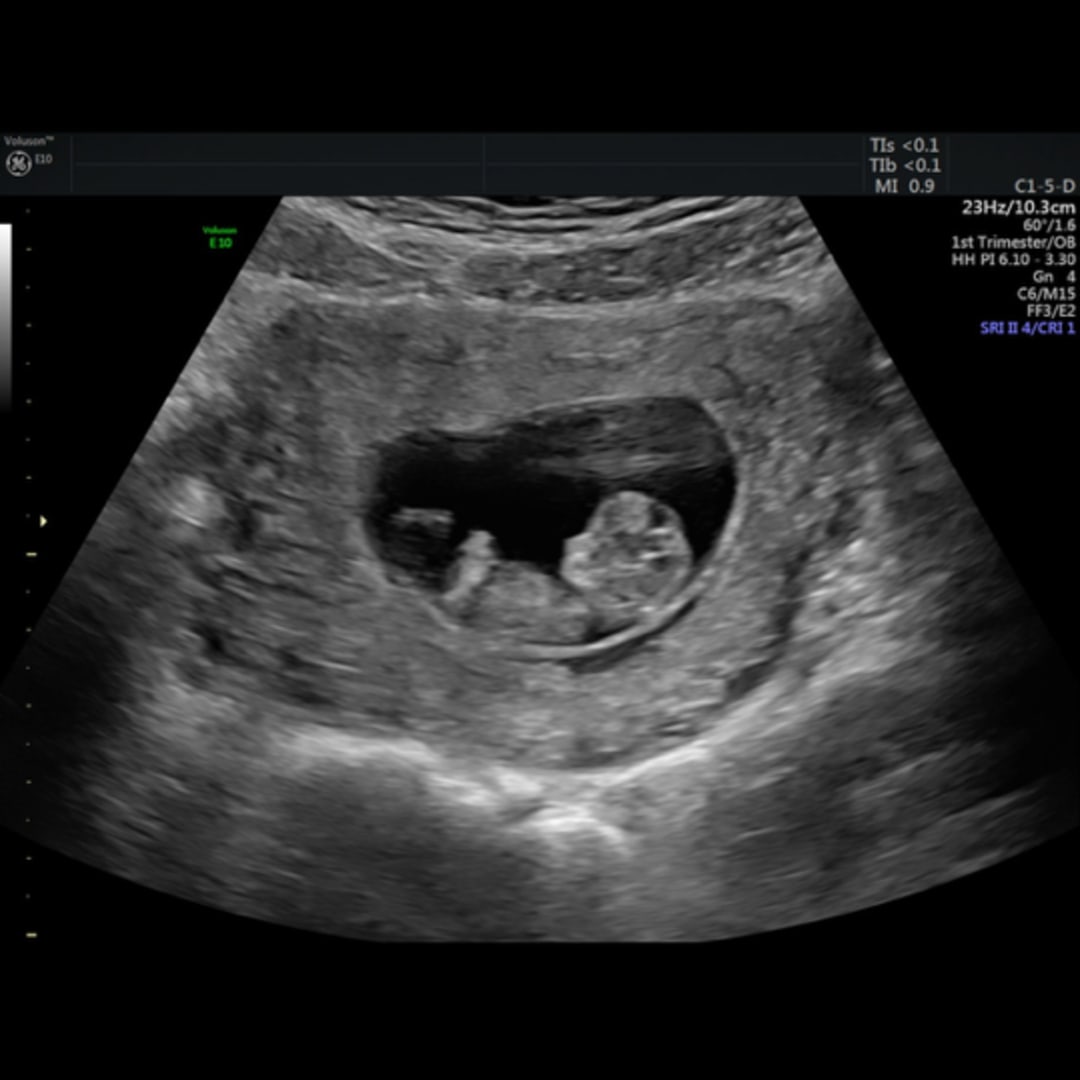 Photo shared by Carlie for their Babylist baby registry.