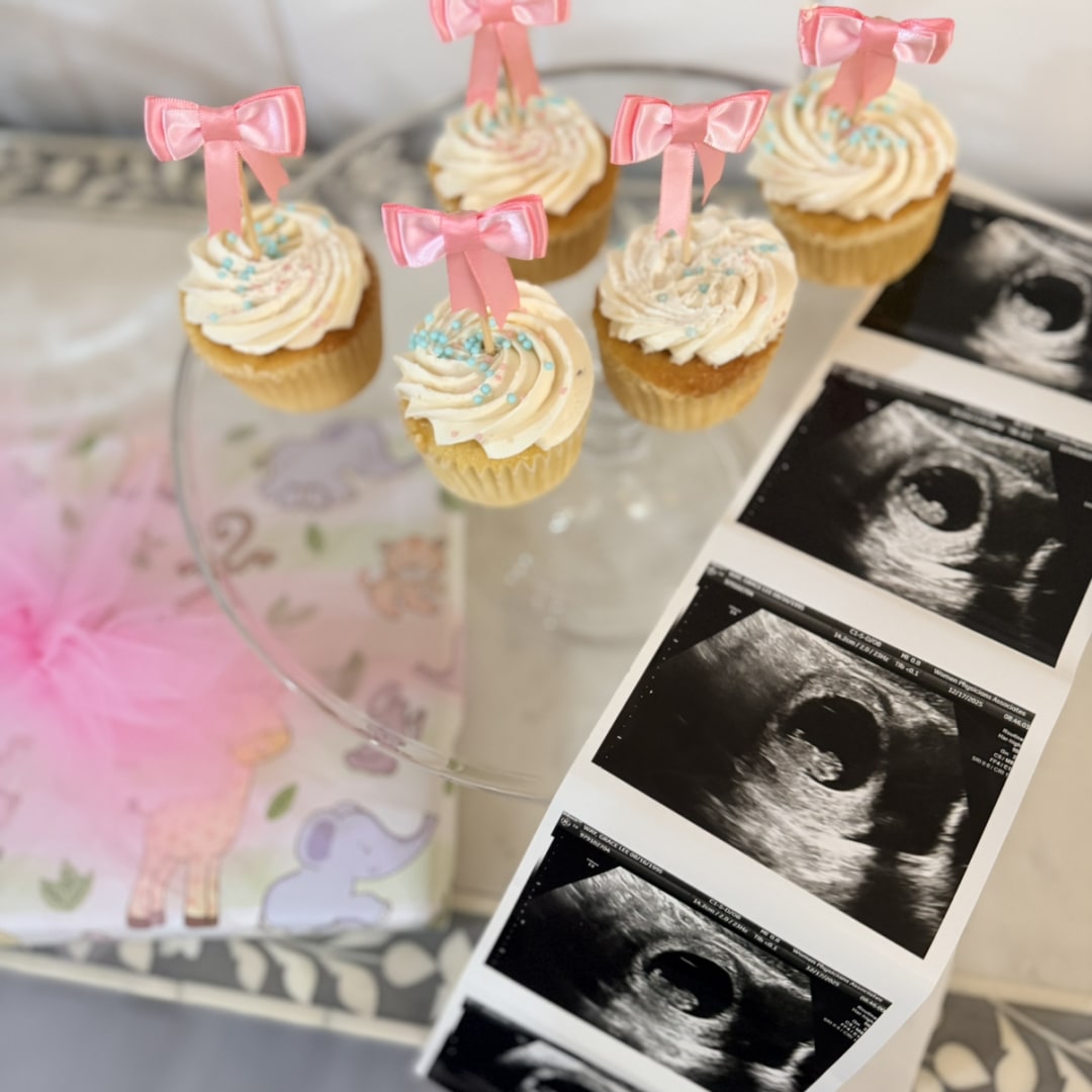 Photo shared by Grace for their Babylist baby registry.