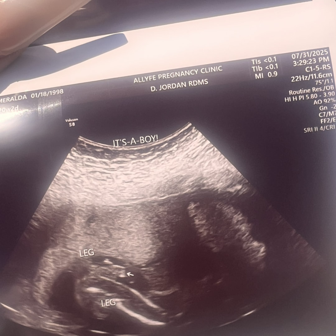 Photo shared by Michael Esmeralda for their Babylist baby registry.