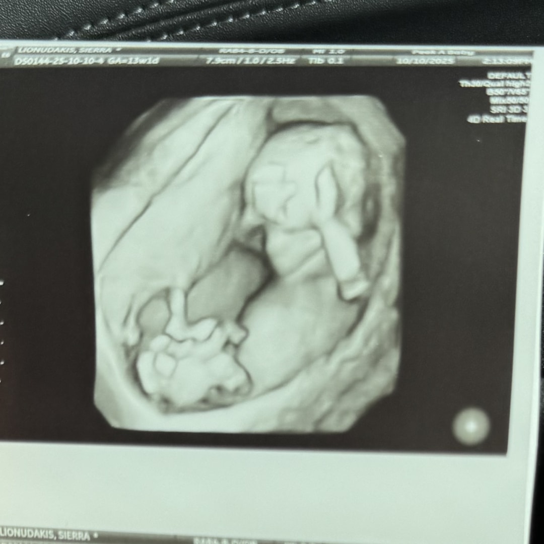 Photo shared by Sierra for their Babylist baby registry.