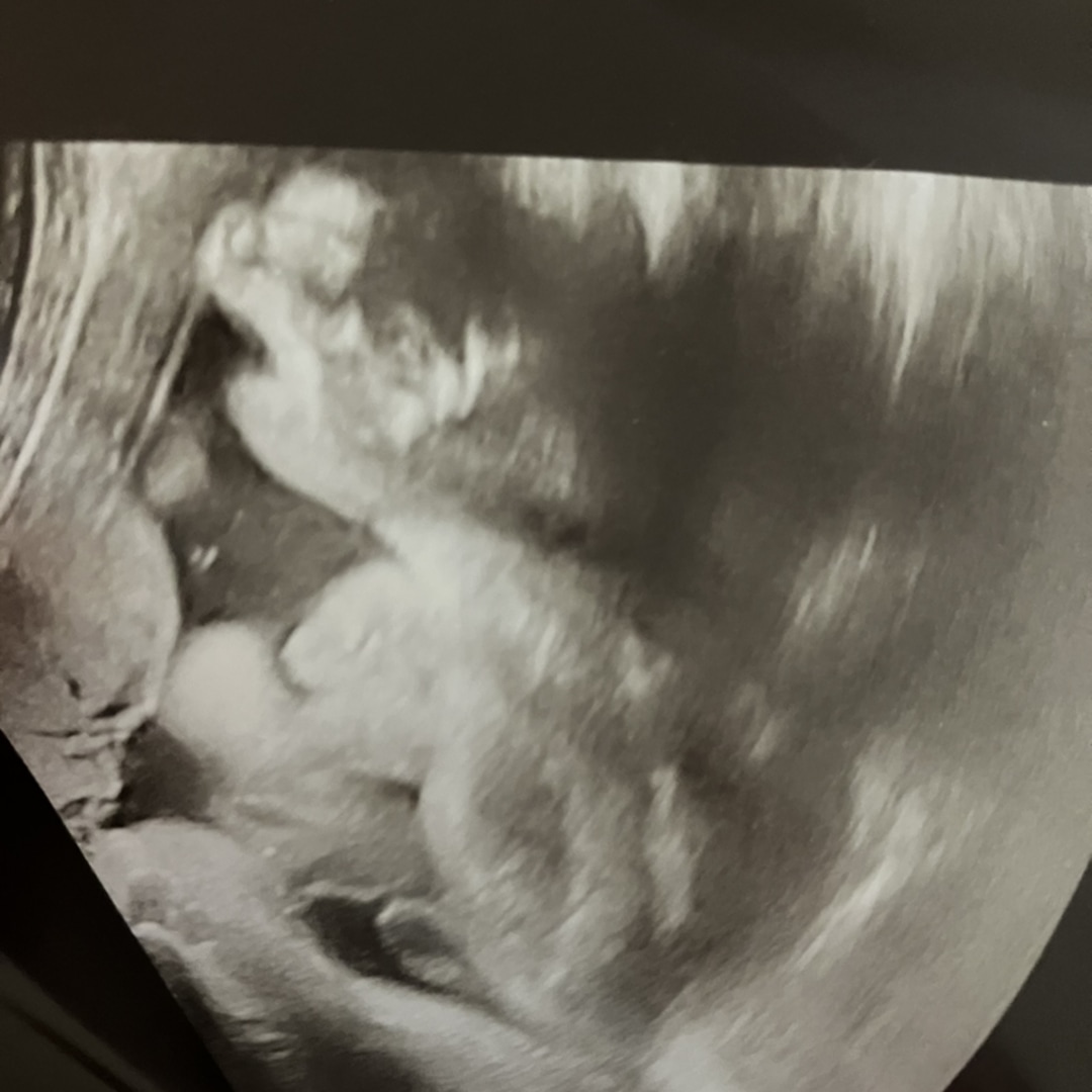 Photo shared by Christine for their Babylist baby registry.