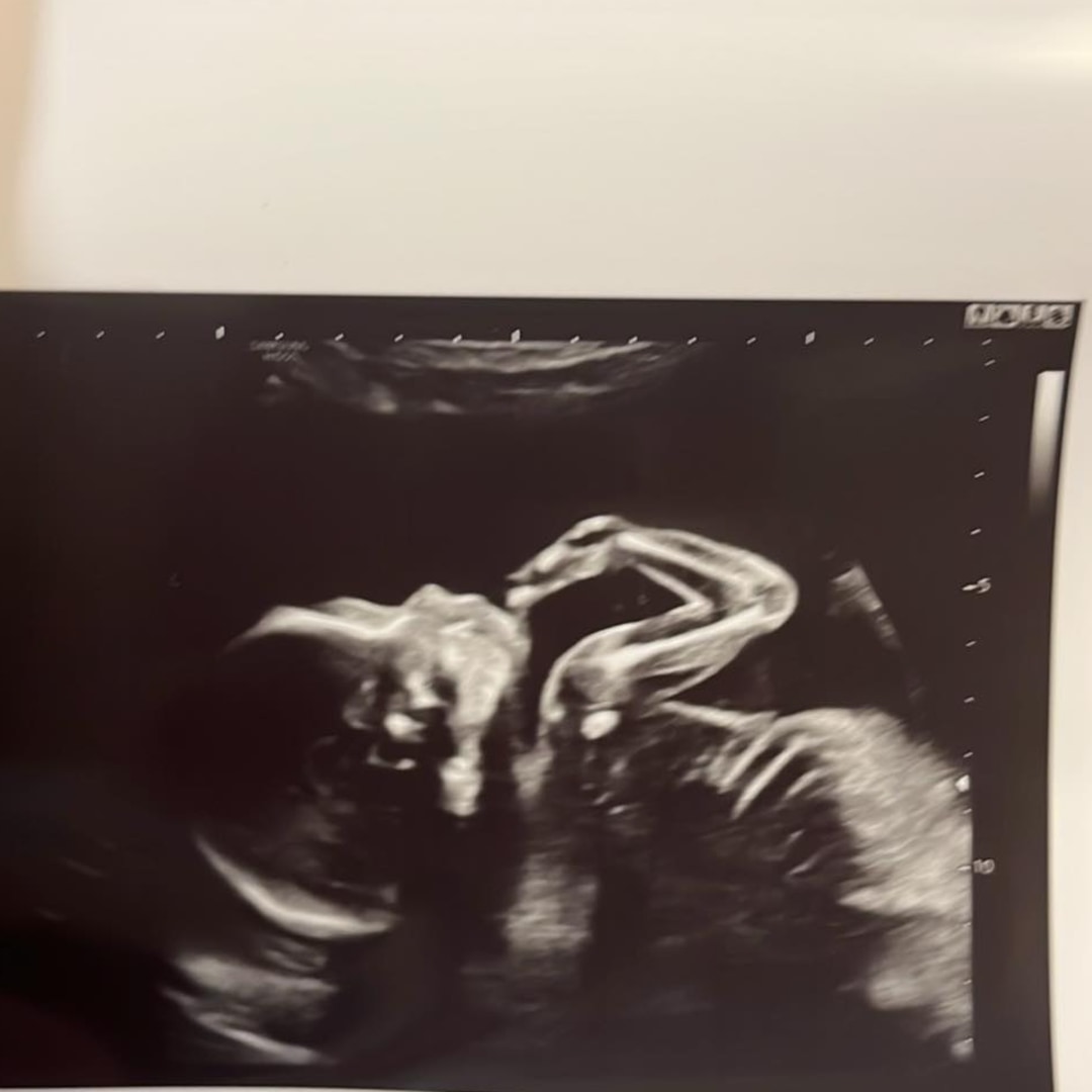 Photo shared by Elsie for their Babylist baby registry.