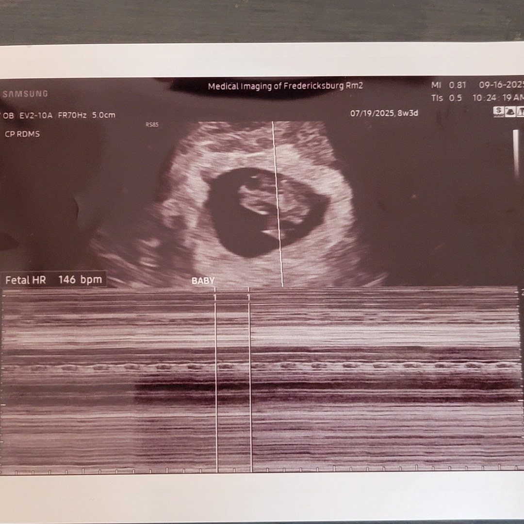 Photo shared by Shannon for their Babylist baby registry.