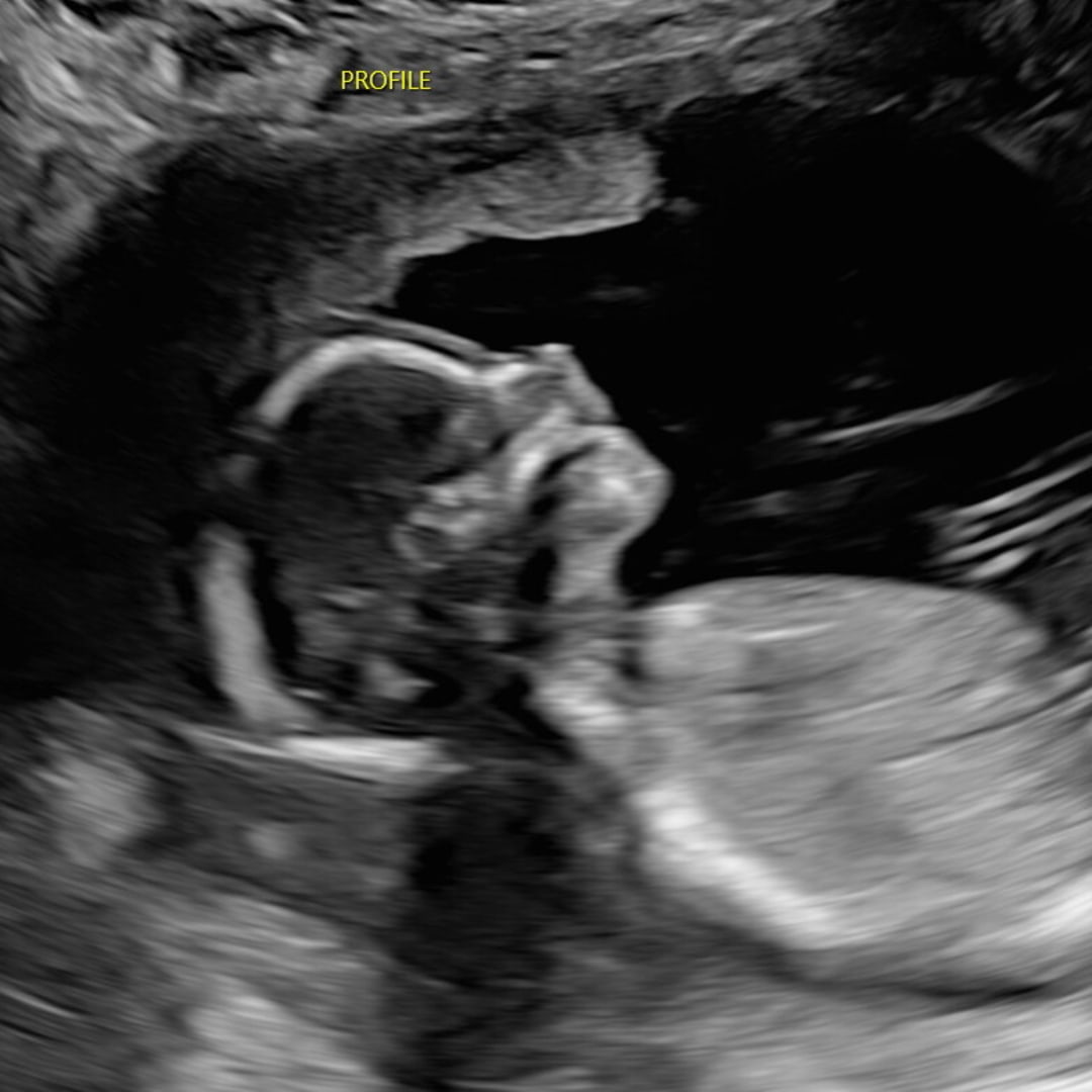 Photo shared by Jenica for their Babylist baby registry.