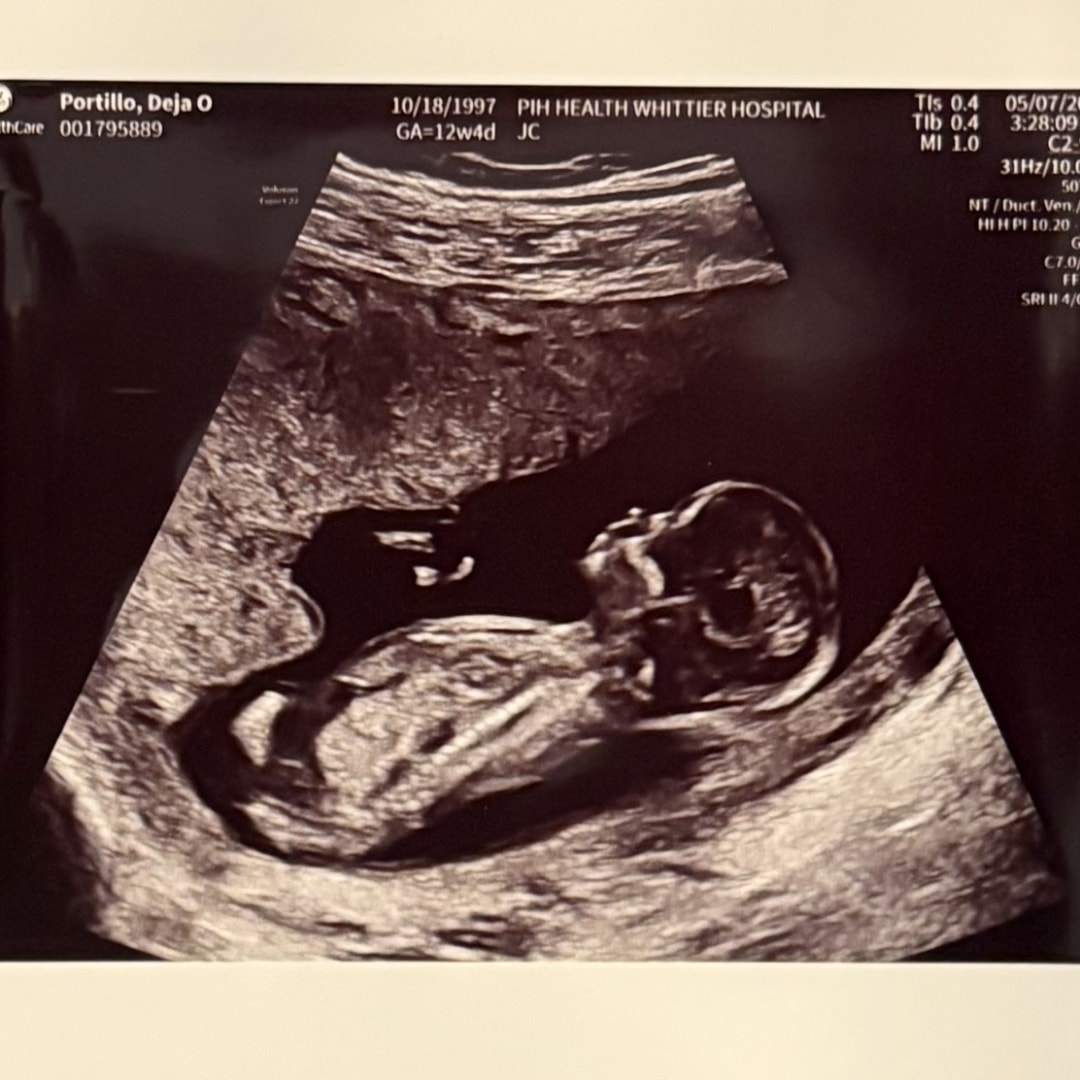 Photo shared by Deja Oriana for their Babylist baby registry.