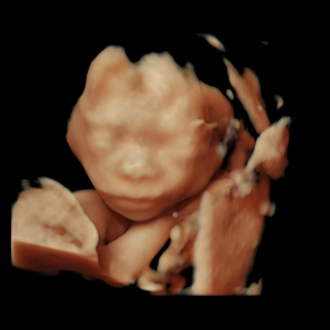 Photo shared by Eva for their Babylist baby registry.
