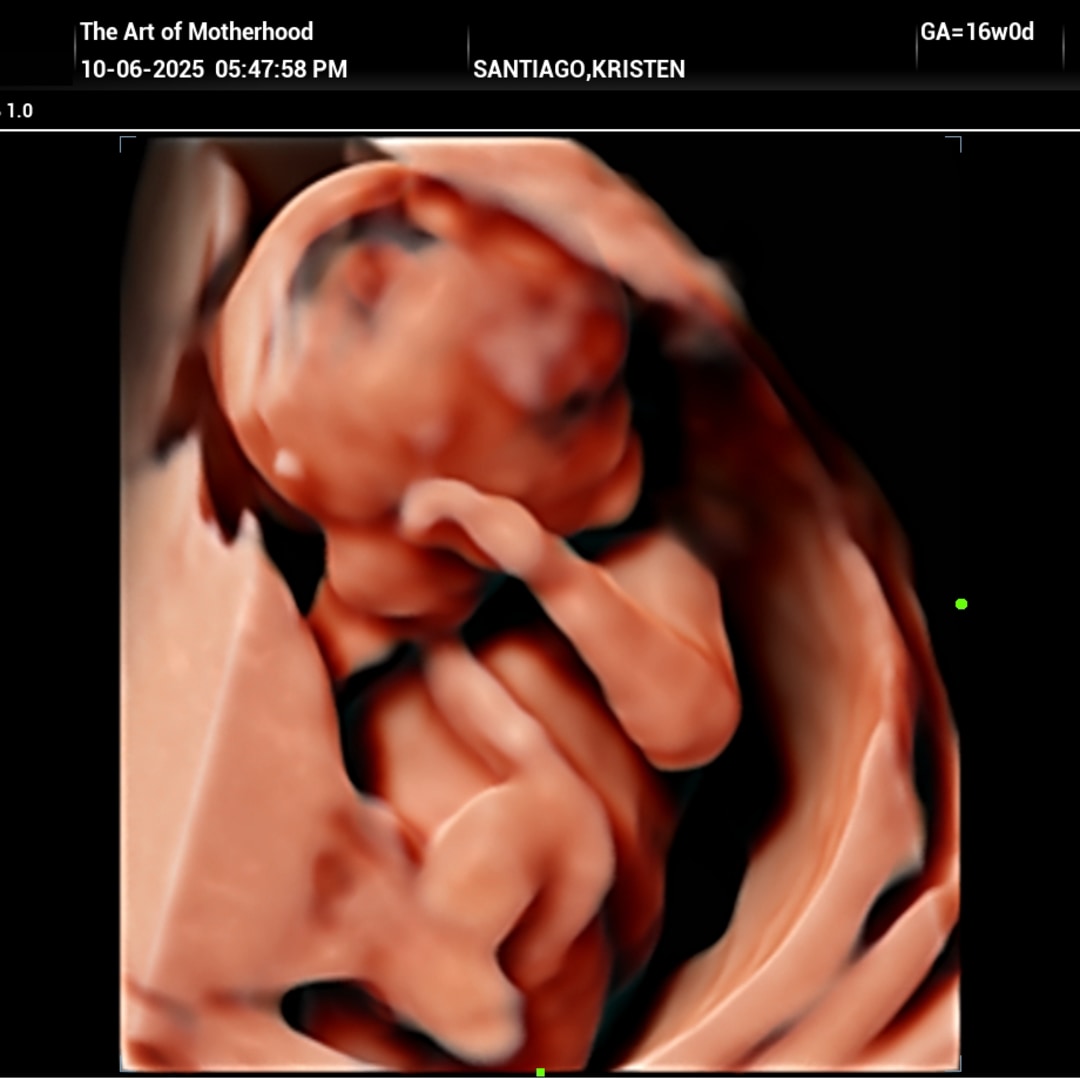 Photo shared by Kristen for their Babylist baby registry.