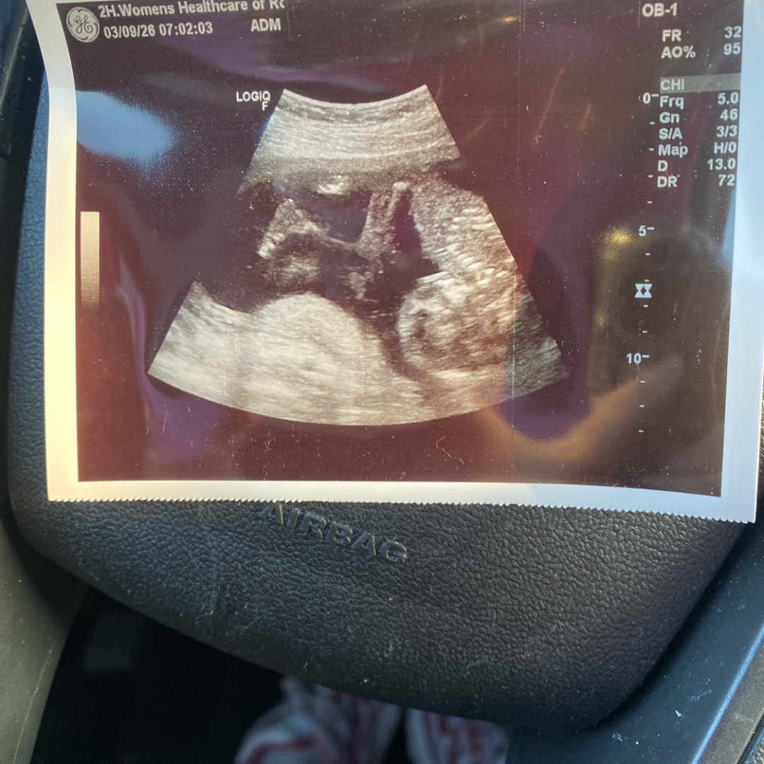 Photo shared by Haylie for their Babylist baby registry.