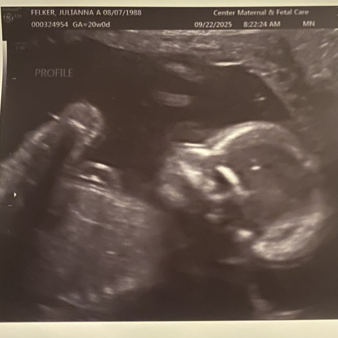Photo shared by Julianna for their Babylist baby registry.