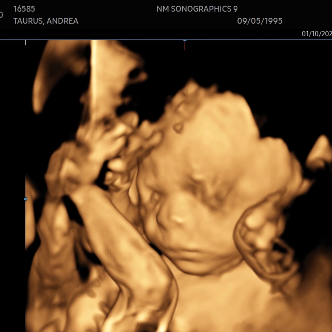 Photo shared by Andrea for their Babylist baby registry.