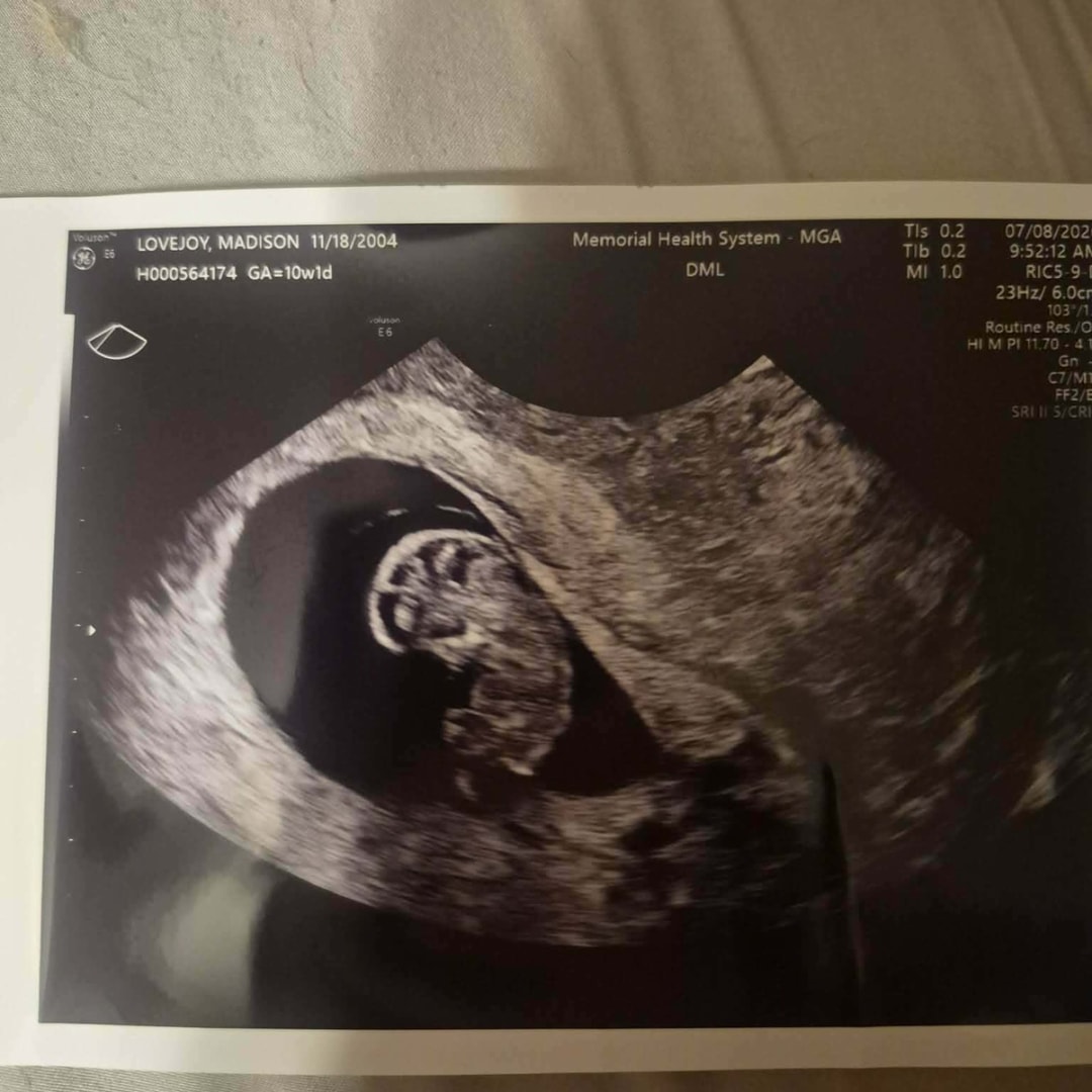 Photo shared by Madi for their Babylist baby registry.