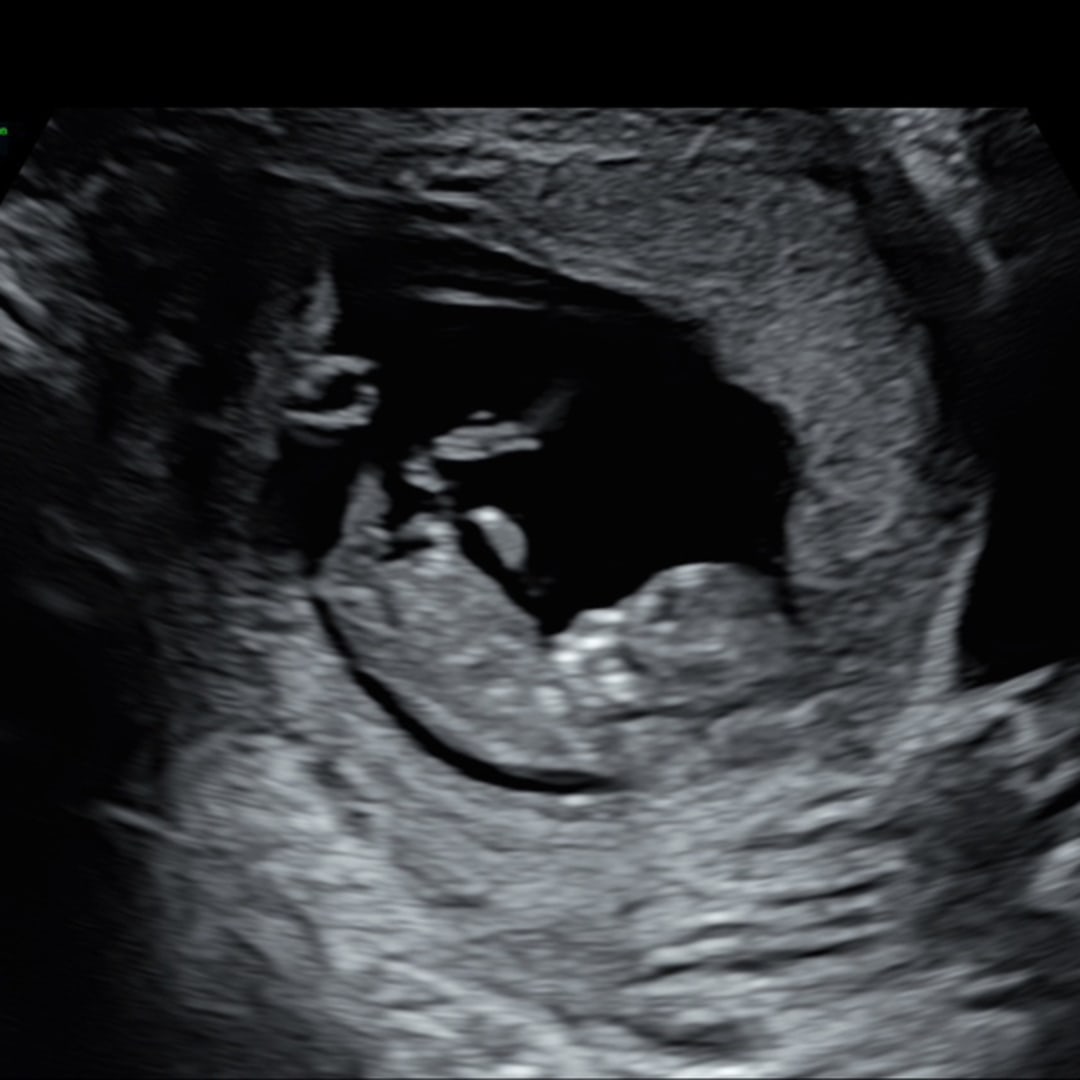 Photo shared by Jazanique for their Babylist baby registry.