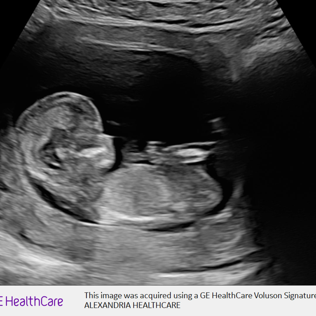 Photo shared by Ashley for their Babylist baby registry.