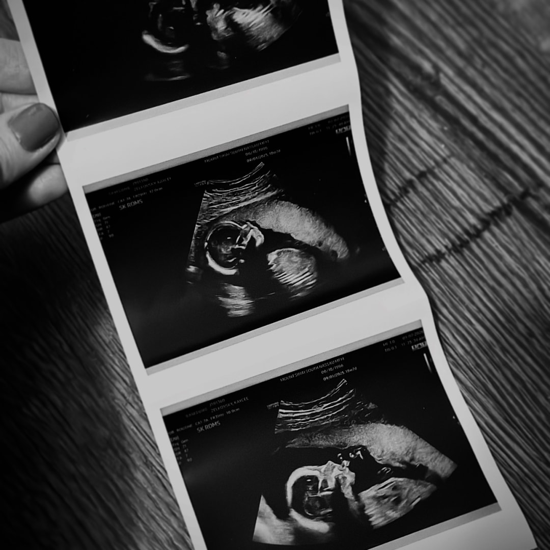 Photo shared by Kaycee for their Babylist baby registry.