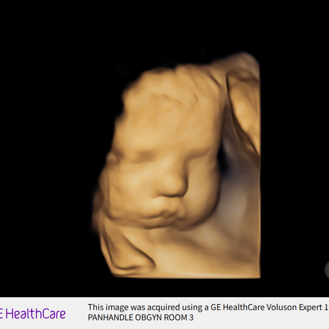 Photo shared by Lindi for their Babylist baby registry.