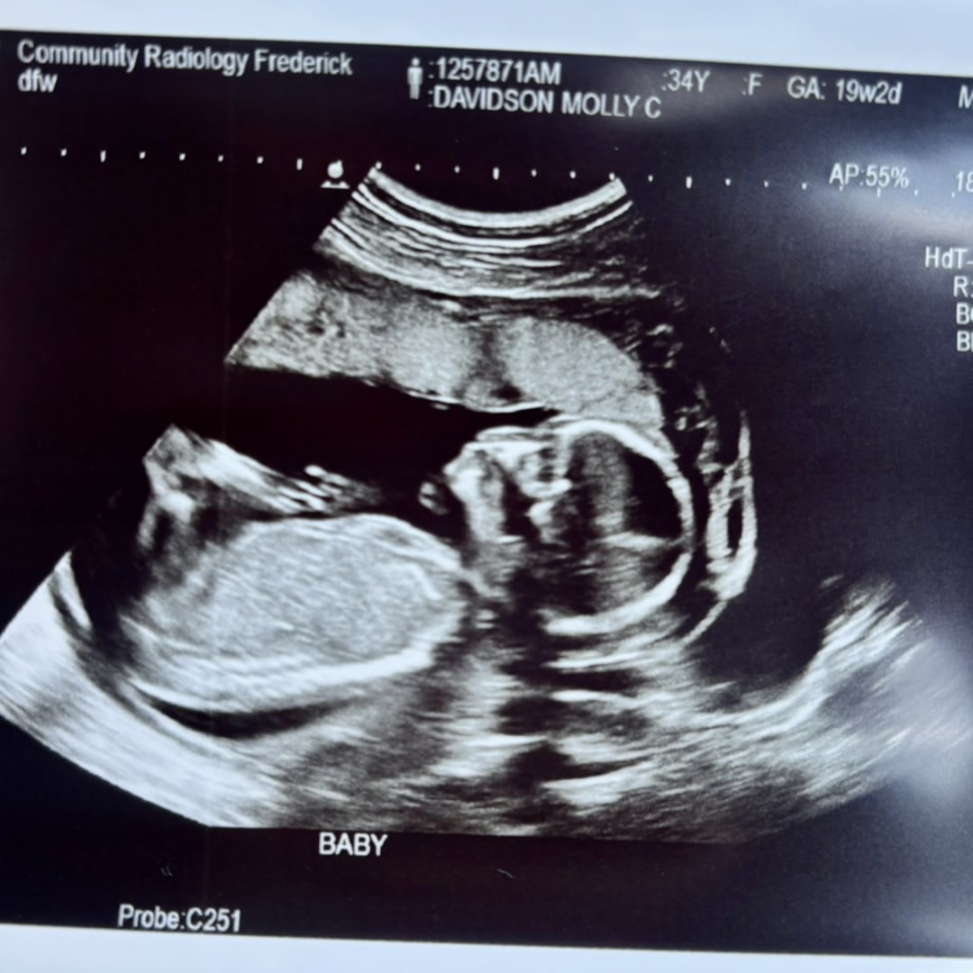 Photo shared by Molly for their Babylist baby registry.