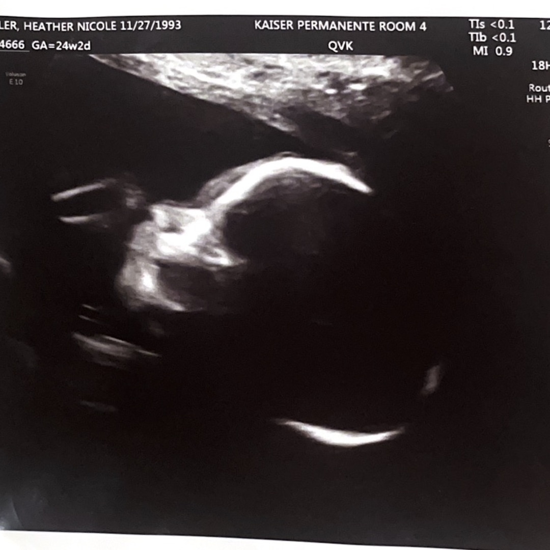 Photo shared by Heather for their Babylist baby registry.