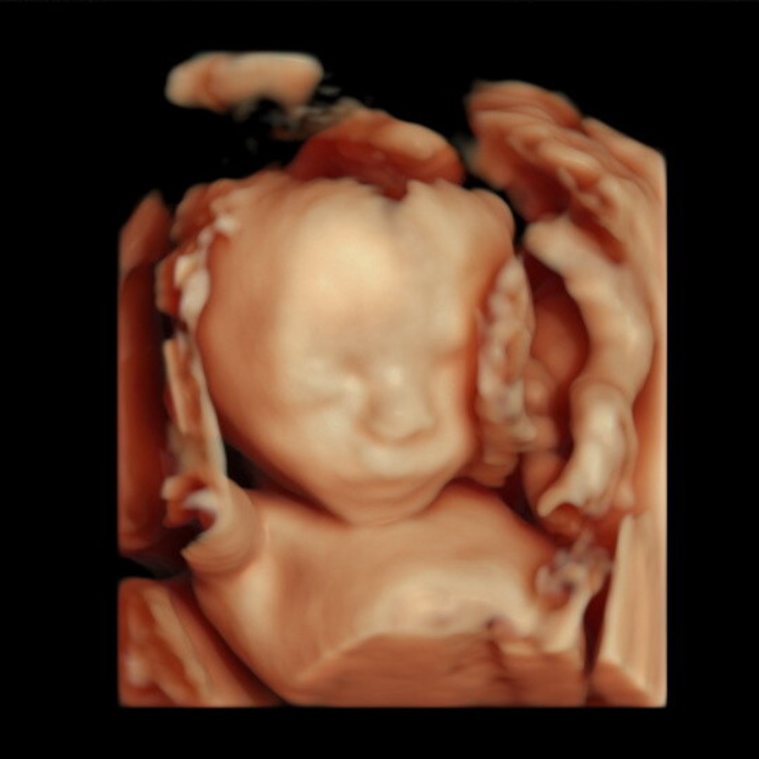 Photo shared by Jesslyn for their Babylist baby registry.