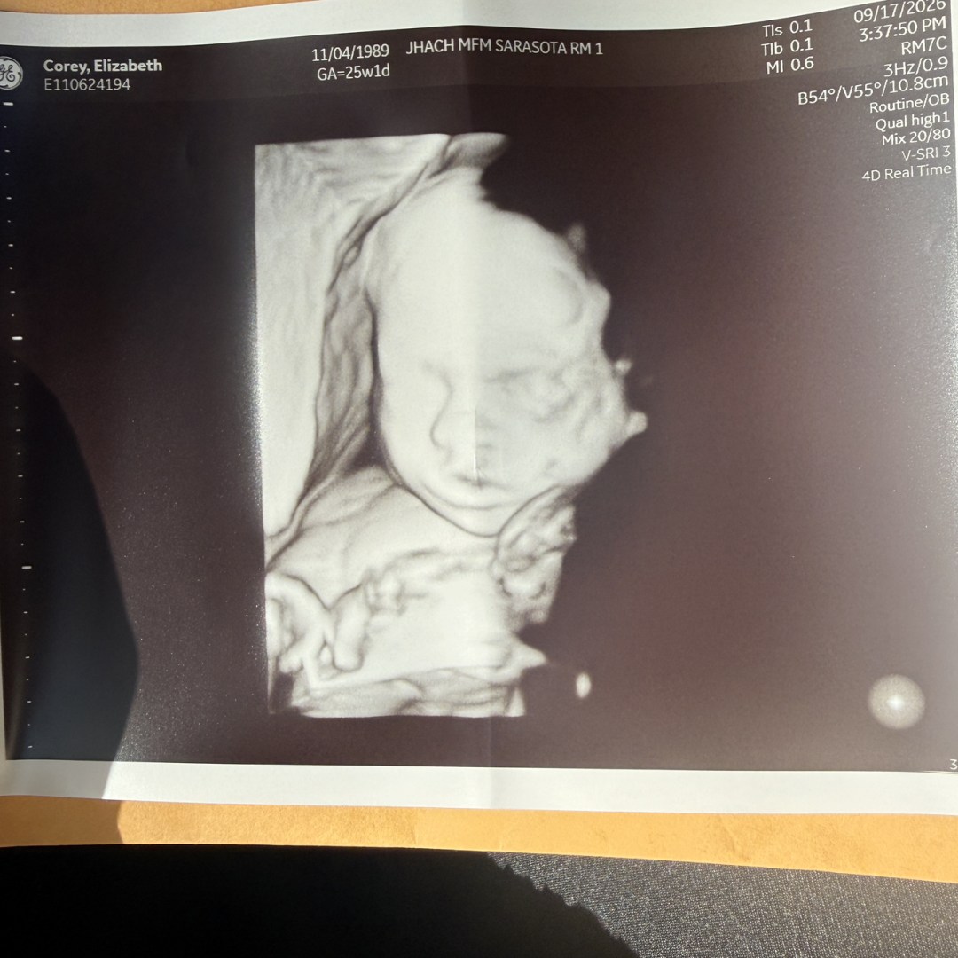 Photo shared by Elizzabeth for their Babylist baby registry.