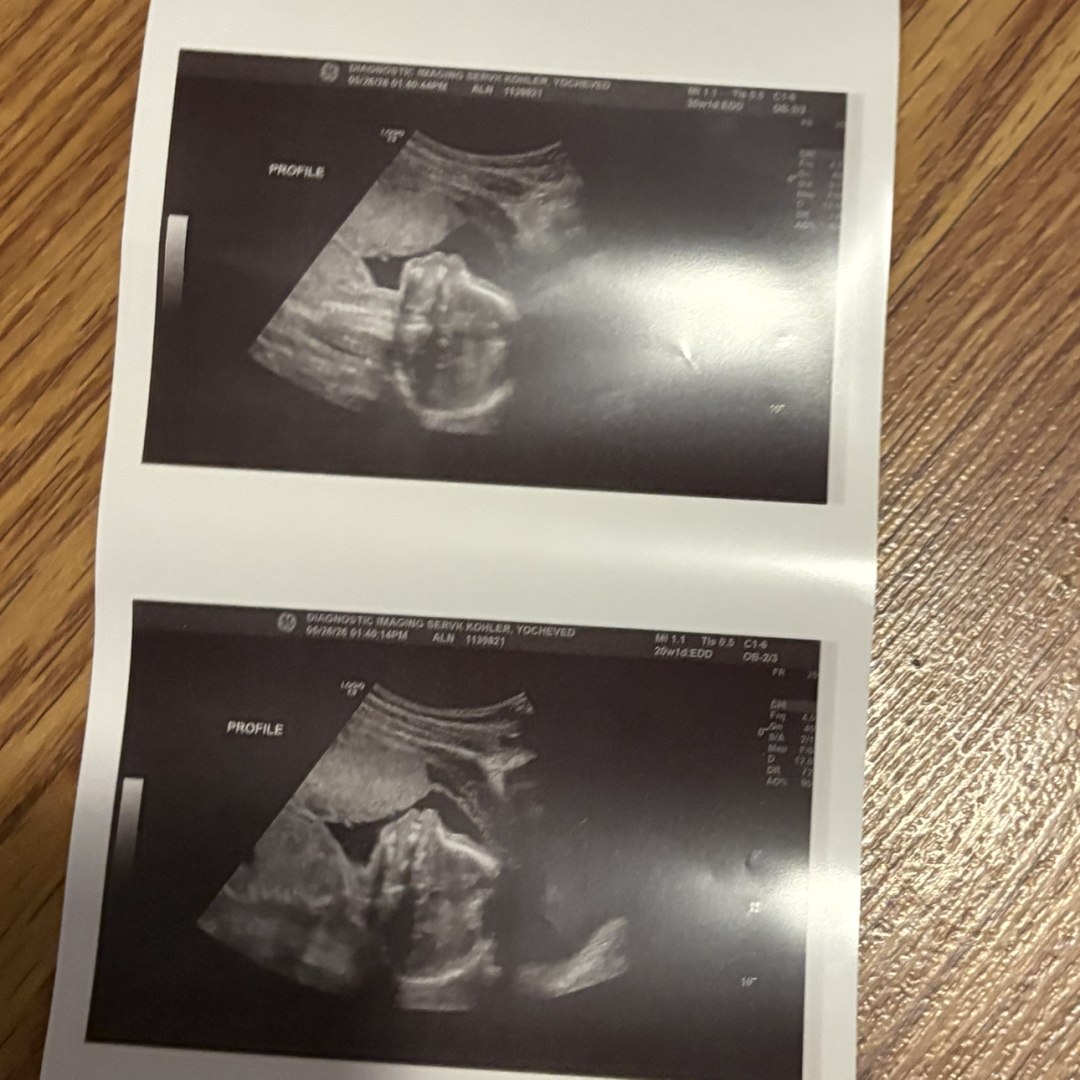 Photo shared by Yocheved for their Babylist baby registry.