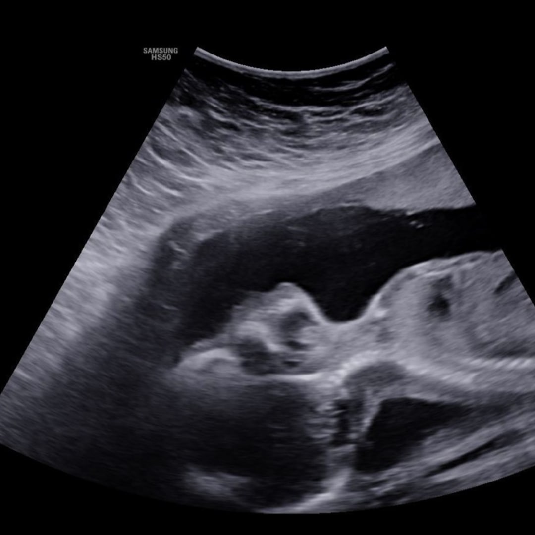 Photo shared by Alyssa for their Babylist baby registry.