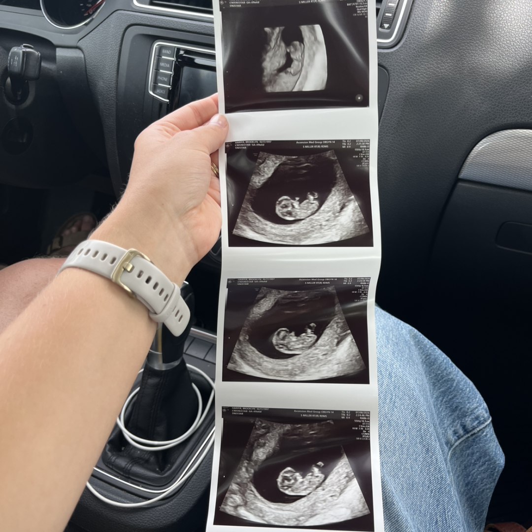 Photo shared by Brooklyn for their Babylist baby registry.