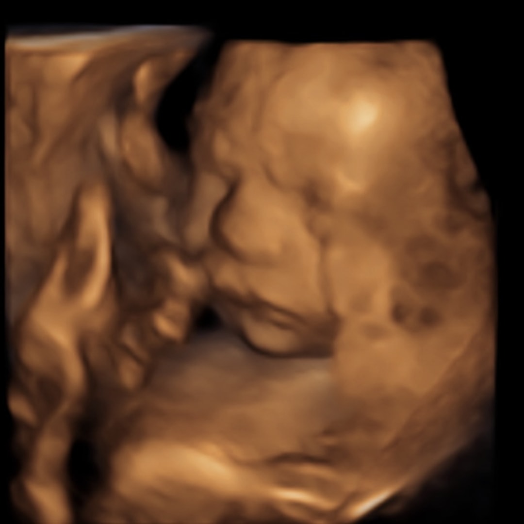 Photo shared by Esteban for their Babylist baby registry.