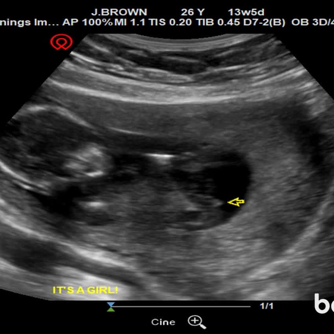 Photo shared by Jayme for their Babylist baby registry.