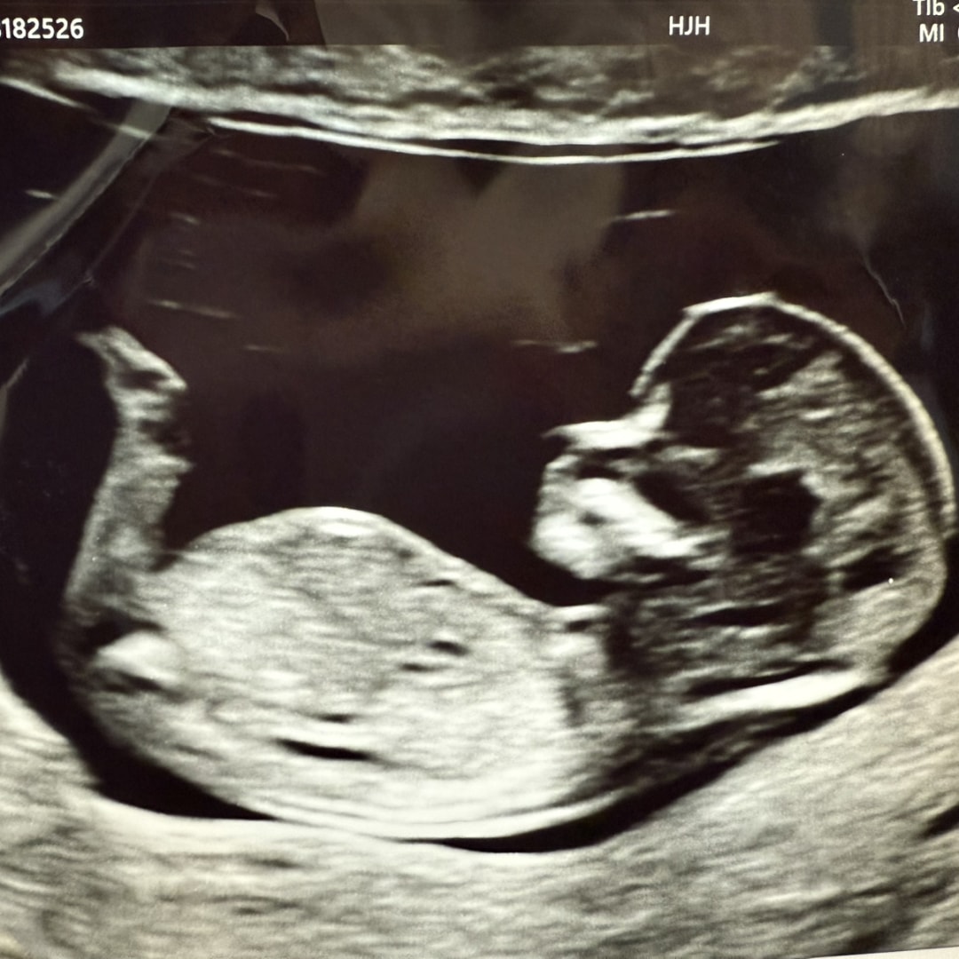 Photo shared by Brenda & Frank for their Babylist baby registry.