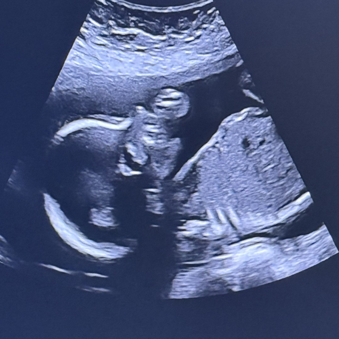 Photo shared by Caitlin for their Babylist baby registry.