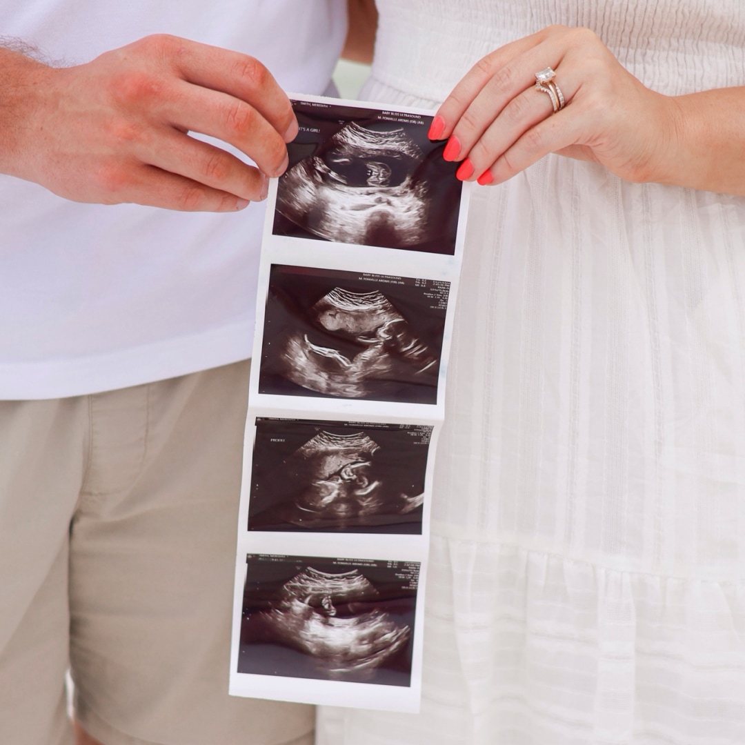 Photo shared by Meredith for their Babylist baby registry.