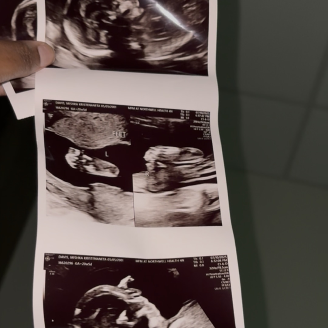 Photo shared by Mishka for their Babylist baby registry.